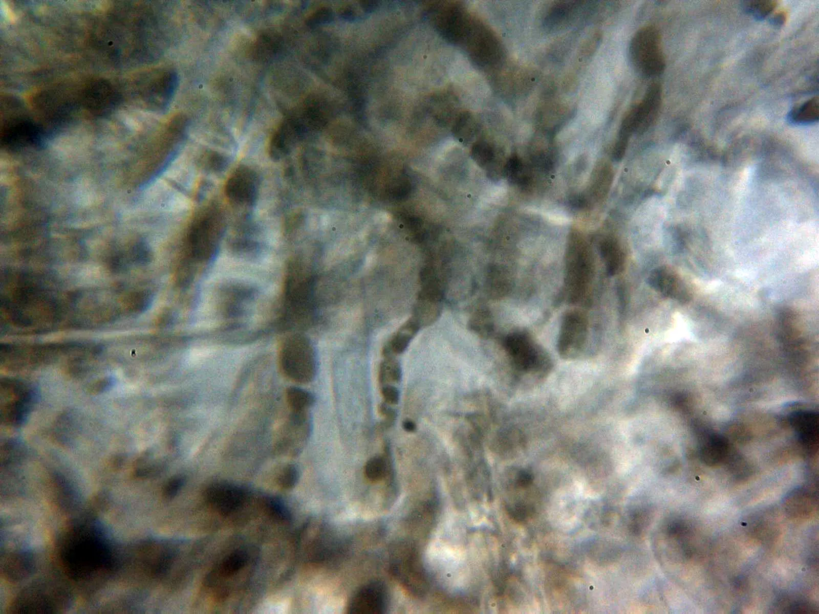 Microscopía de Russula anthracina - 10 - Suprapellis 1